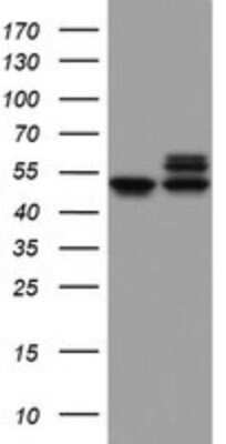 Western Blot: NDUFS2 Antibody (OTI1D5) [NBP2-46127]