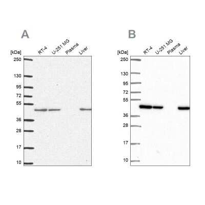 Western Blot: NDUFS2 Antibody [NBP2-30413]