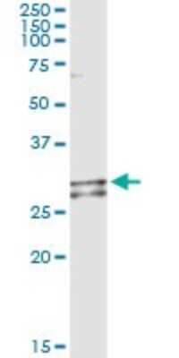 Immunoprecipitation: NDUFS3 Antibody (1D6) [H00004722-M02]