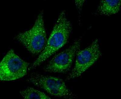 Immunocytochemistry/ Immunofluorescence: NDUFS3 Antibody (JU10-32) [NBP2-75587]