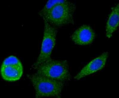 Immunocytochemistry/ Immunofluorescence: NDUFS3 Antibody (JU10-32) [NBP2-75587]
