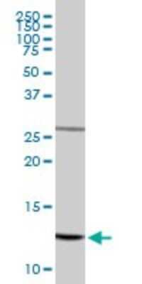 Western Blot: NDUFS5 Antibody [H00004725-D01P]