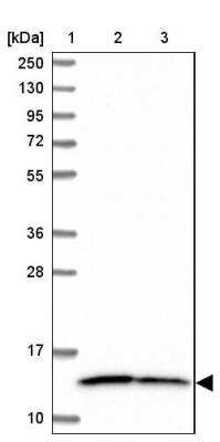 Western Blot: NDUFS5 Antibody [NBP2-13648]