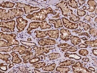 Immunohistochemistry: NDUFS6 Antibody [NBP3-06007]