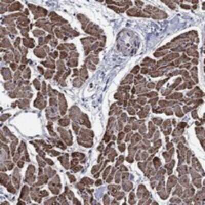 Immunohistochemistry-Paraffin: NDUFS8 Antibody [NBP3-17899]