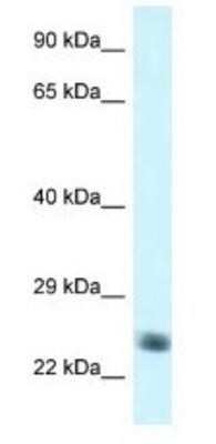 Western Blot: NDUFS8 Antibody [NBP1-79907]
