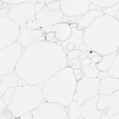 Immunohistochemistry-Paraffin: NDUFV2 Antibody [NBP1-84475]