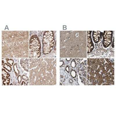 Immunohistochemistry-Paraffin: NDUFV3 Antibody [NBP1-85621]