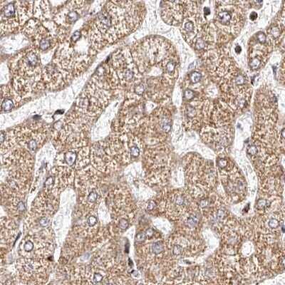 Immunohistochemistry-Paraffin: NDUFV3 Antibody [NBP1-85621]