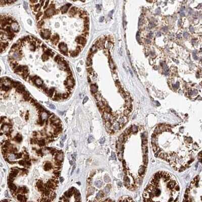 Immunohistochemistry-Paraffin: NDUFV3 Antibody [NBP1-85621]