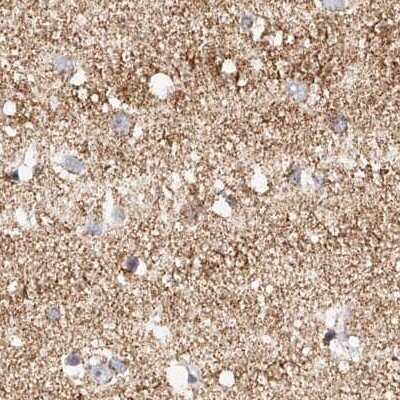 Immunohistochemistry-Paraffin: NDUFV3 Antibody [NBP1-85621]