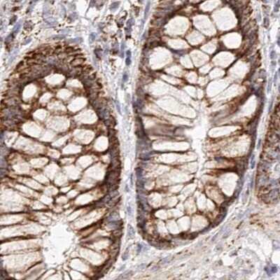 Immunohistochemistry-Paraffin: NDUFV3 Antibody [NBP1-85621]