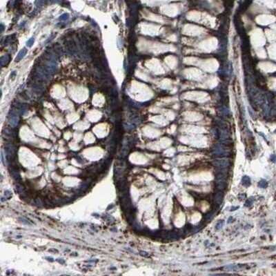 Immunohistochemistry-Paraffin: NDUFV3 Antibody [NBP1-85622]