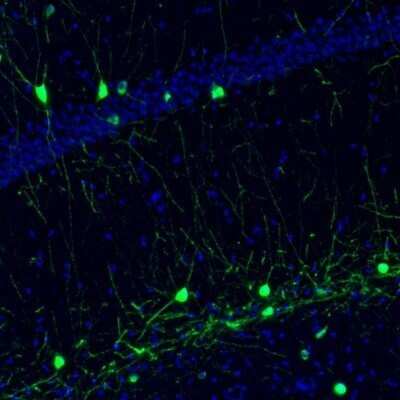 Immunohistochemistry: NECAB1 Antibody [NBP1-84004]