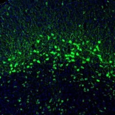Immunohistochemistry: NECAB1 Antibody [NBP1-84004]