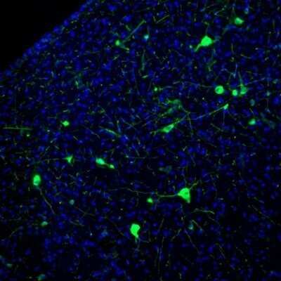 Immunohistochemistry: NECAB1 Antibody [NBP1-84004]