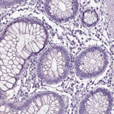 Immunohistochemistry-Paraffin: NECAB1 Antibody [NBP1-84003]