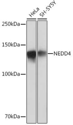 Western Blot: NEDD4 Antibody (7R0M4) [NBP3-16398]