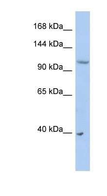 Western Blot: NEDD4L Antibody [NBP1-54974]