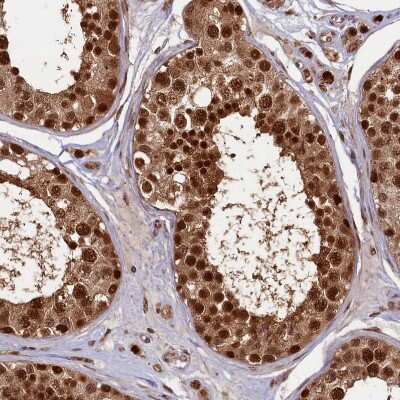 Immunohistochemistry-Paraffin: APPBP1 Antibody [NBP1-92163]