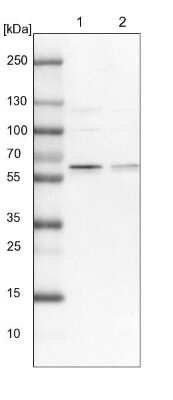 Western Blot: APPBP1 Antibody [NBP1-92162]