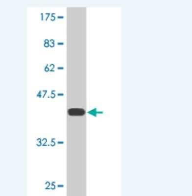 Western Blot: NEDL2 Antibody (1A3) [H00057520-M02]