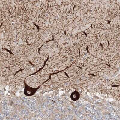 Immunohistochemistry-Paraffin: NEDL2 Antibody [NBP1-92174]
