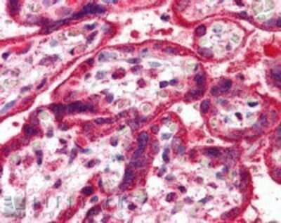 Immunohistochemistry-Paraffin: NEIL1 Antibody [NB300-881]
