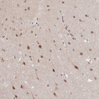 Immunohistochemistry-Paraffin: NEIL1 Antibody [NBP2-47358]