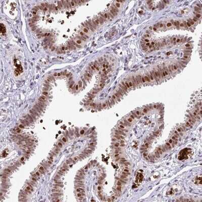 Immunohistochemistry-Paraffin: NEIL1 Antibody [NBP2-47358]