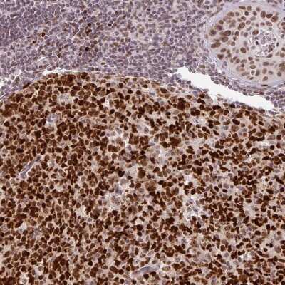 Immunohistochemistry-Paraffin: NEIL1 Antibody [NBP2-47358]