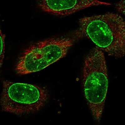 Immunocytochemistry/ Immunofluorescence: NEK1 Antibody [NBP1-82883]
