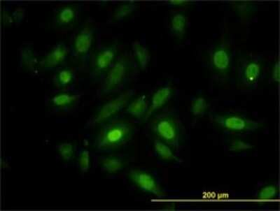 Immunocytochemistry/ Immunofluorescence: NEK10 Antibody (1C9) [H00152110-M01]