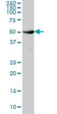 Western Blot: NEK10 Antibody (1C9) [H00152110-M01]