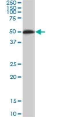 Western Blot: NEK10 Antibody (1C9) [H00152110-M01]