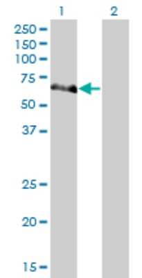 Western Blot: NEK10 Antibody (1C9) [H00152110-M01]