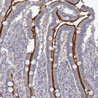 Immunohistochemistry-Paraffin: NEK10 Antibody [NBP1-81991]