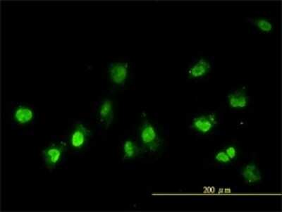 Immunocytochemistry/ Immunofluorescence: NEK11 Antibody (4E1-1F4) [H00079858-M01]