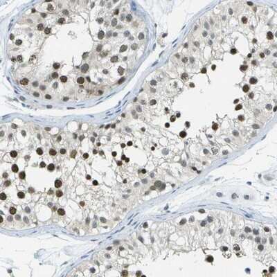 Immunohistochemistry-Paraffin: NEK11 Antibody [NBP1-83584]