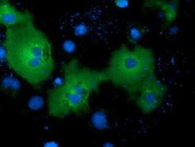 Immunocytochemistry/ Immunofluorescence: NEK11 Antibody (OTI4H5) - Azide and BSA Free [NBP2-72933]