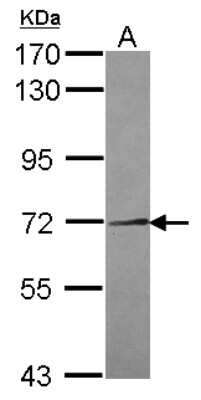 Western Blot: NEK11 Antibody [NBP2-19509]