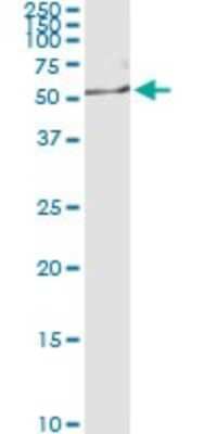 Immunoprecipitation: NEK2 Antibody (2F6) [H00004751-M01]