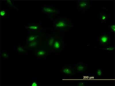 Immunocytochemistry/ Immunofluorescence: NEK2 Antibody (3B7) [H00004751-M11]