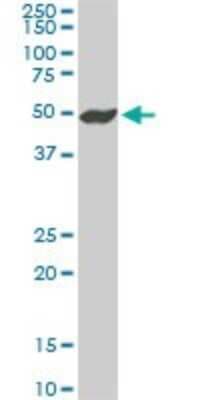 Western Blot: NEK2 Antibody (3B7) [H00004751-M11]