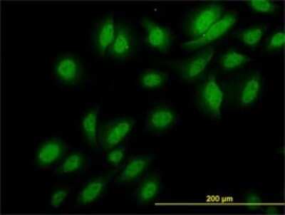 Immunocytochemistry/ Immunofluorescence: NEK3 Antibody (2F8) [H00004752-M01]
