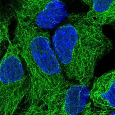 Immunocytochemistry/ Immunofluorescence: NEK3 Antibody [NBP2-13650]
