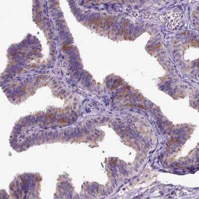 Immunohistochemistry-Paraffin: NEK5 Antibody [NBP1-85903]