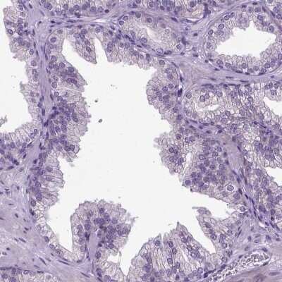 Immunohistochemistry-Paraffin: NEK5 Antibody [NBP1-85903]