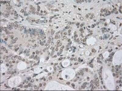 Immunohistochemistry: NEK6 Antibody (OTI5D7) - Azide and BSA Free [NBP2-72938]