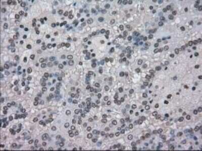 Immunohistochemistry: NEK6 Antibody (OTI5D7) - Azide and BSA Free [NBP2-72938]